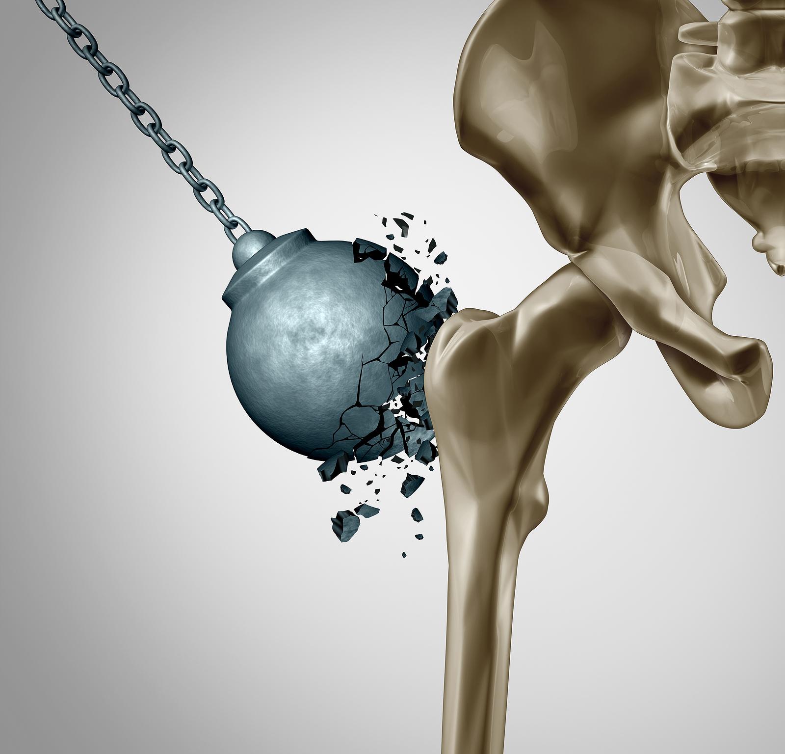 Nutritional Foundations for Strong Bones